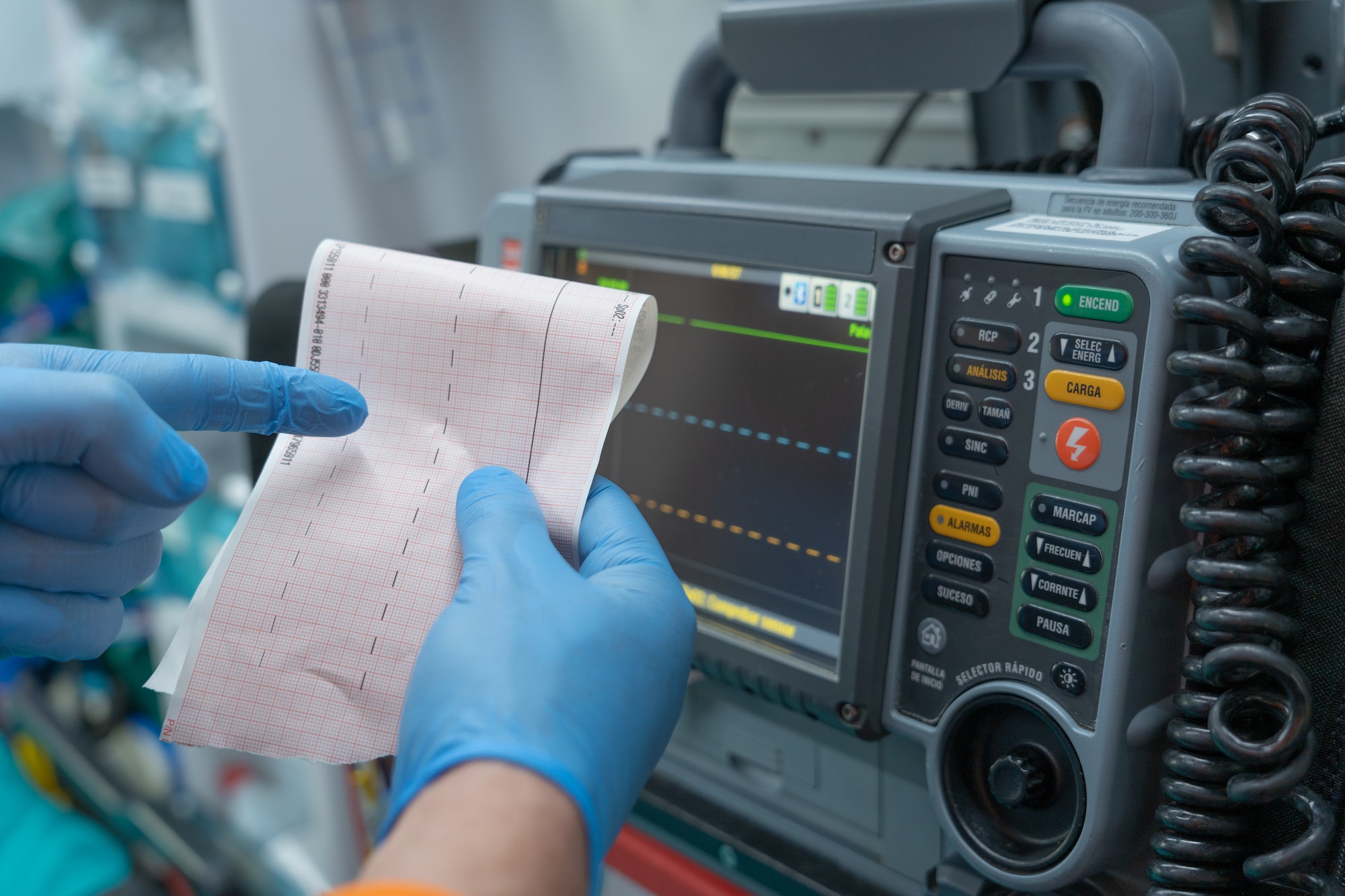 close-up of hands with surgical gloves pointing to an electrocardiogram.