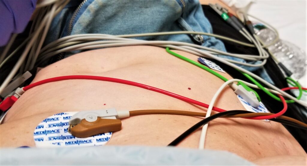 Healthcare and Medicine! ER Patient on an EKG Monitor!