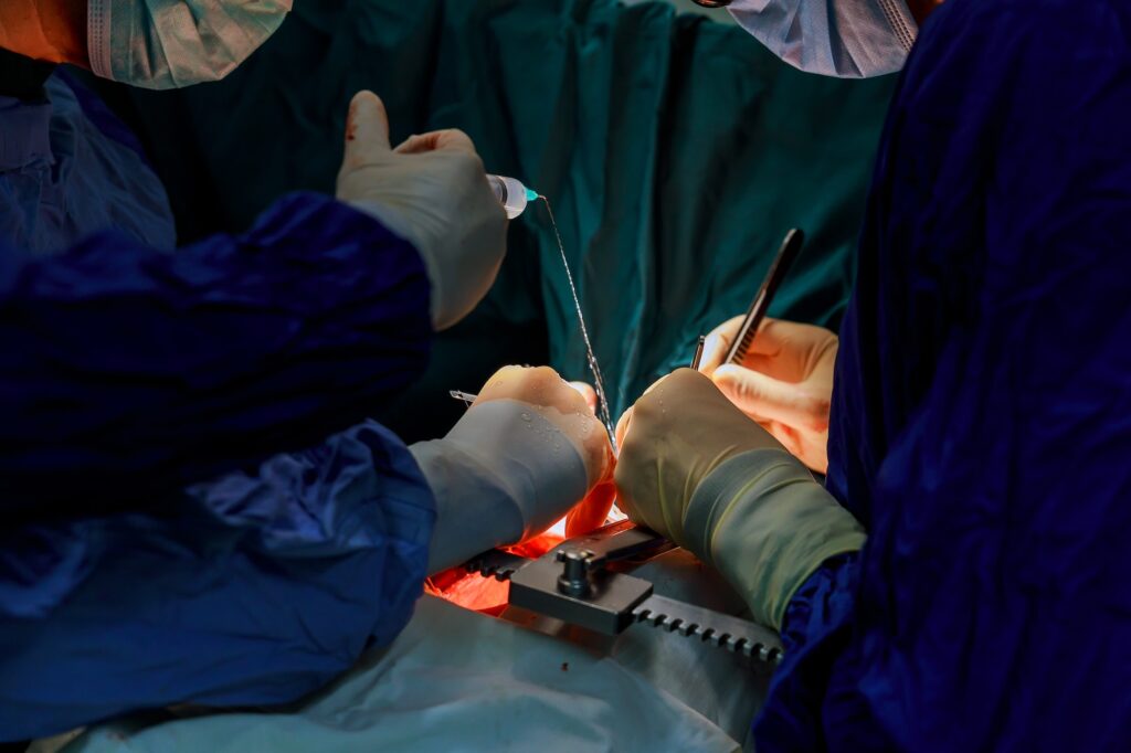 Heart surgery. Open heart surgery. Coronary artery bypass surger in operating room